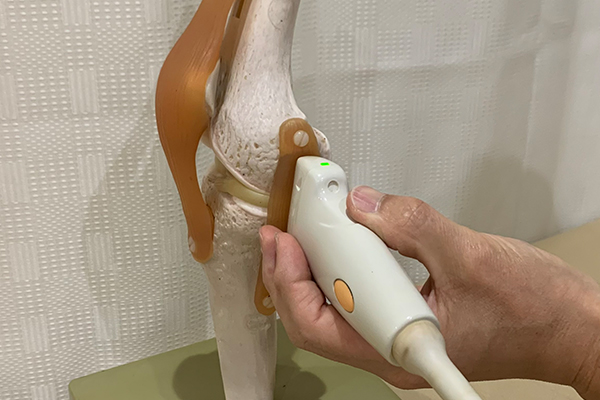 右膝を内方から観察します